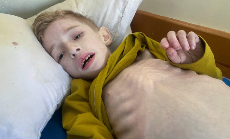 Gaza's Starving Children Fill Hospital Wards Amid Looming Famine