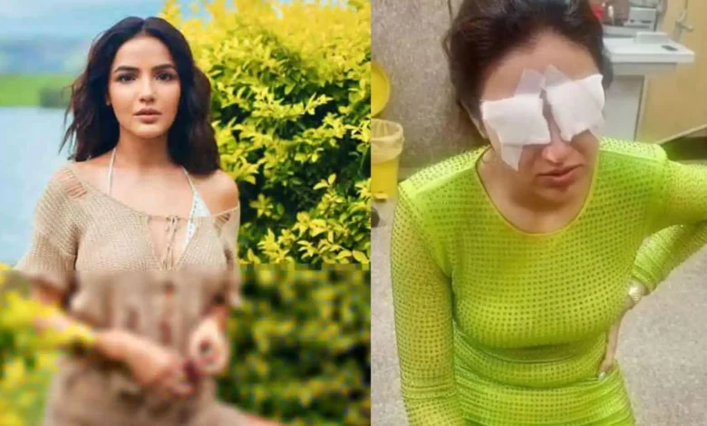 TV Star Jasmin Bhasin Suffers Corneal Damage in Lens Mishap