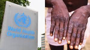 WHO holds emergency meet to ensure fair Mpox medical access