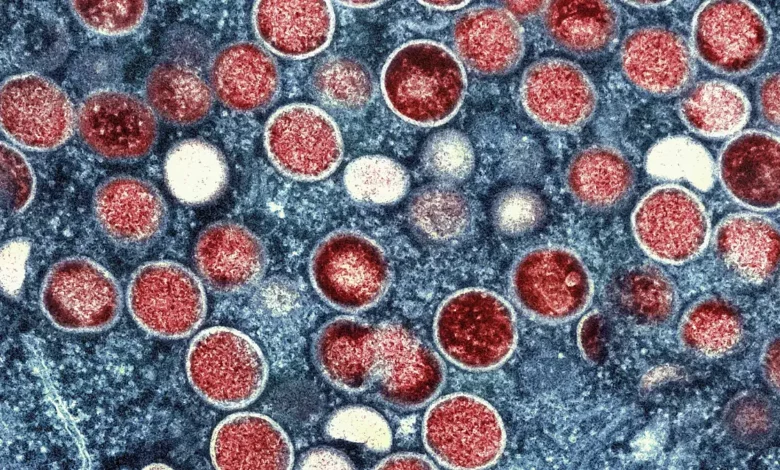 Sweden Confirms First Mpox Case of Dangerous Variant